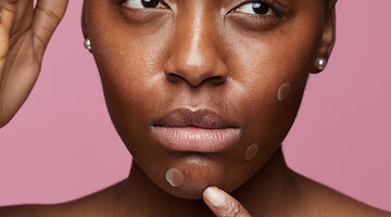 Azelaic acid